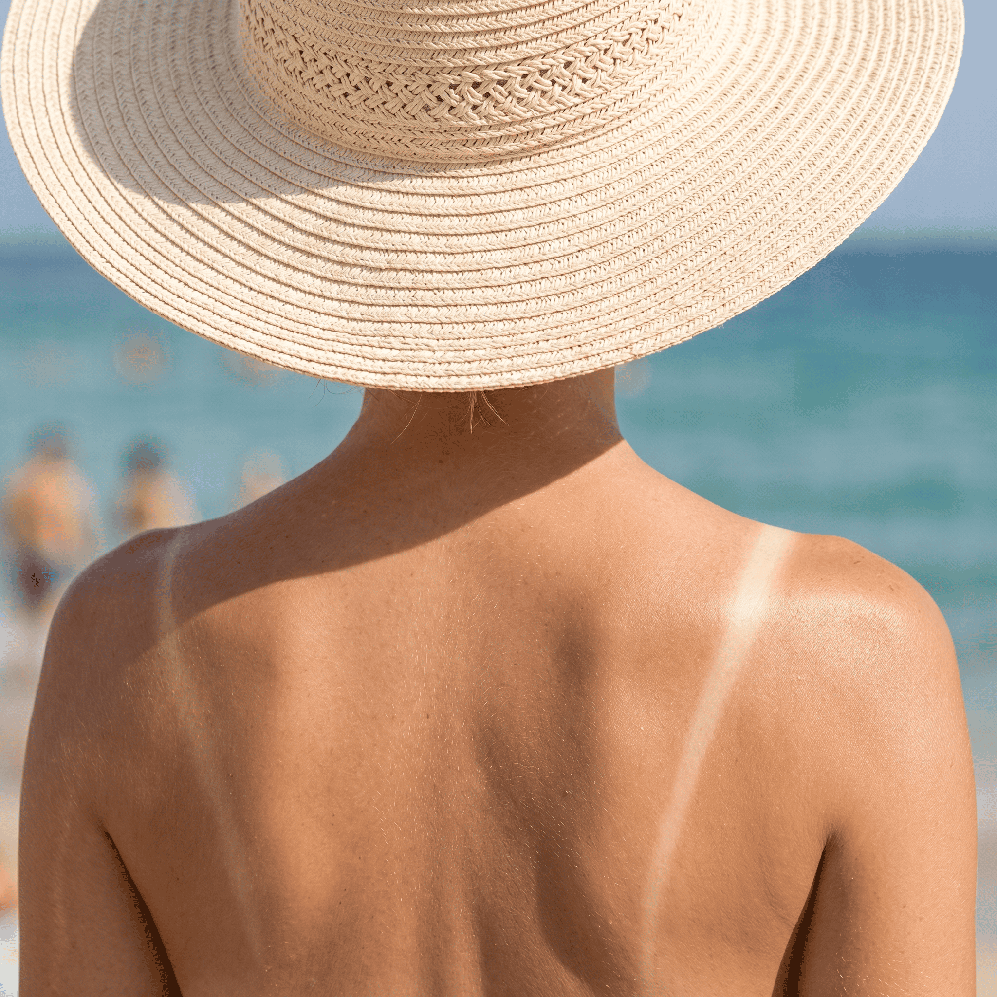 Sun Damage