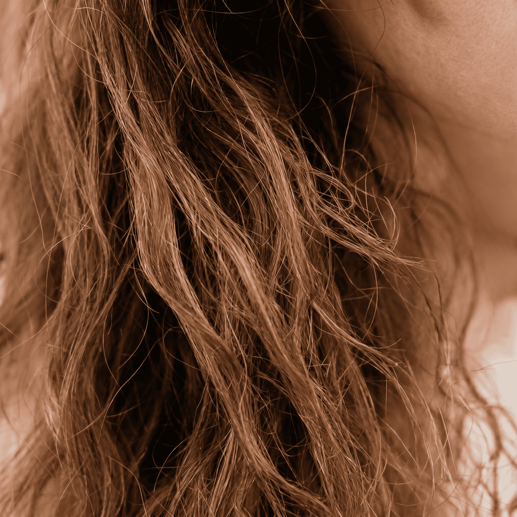 Oily Scalp